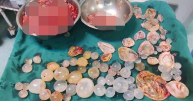 પાંચ વર્ષની પીડાનો સુખદ અંત: ગાંધીનગર સિવિલના તબીબોએ લીવરમાંથી હજારો ‘ડોટર સિસ્ટ’ દૂર કરી યુવાનને ઉગાર્યો